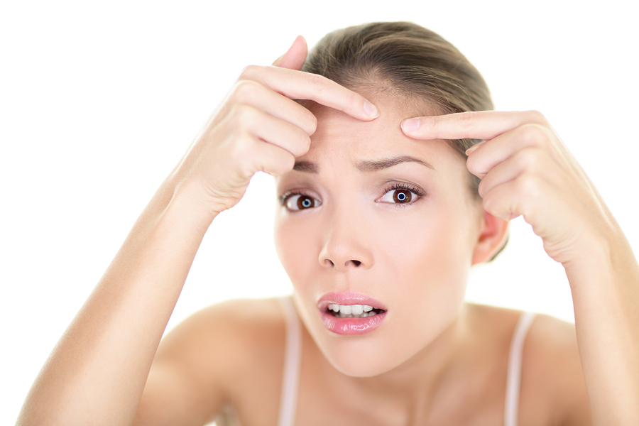acne-1.jpg
