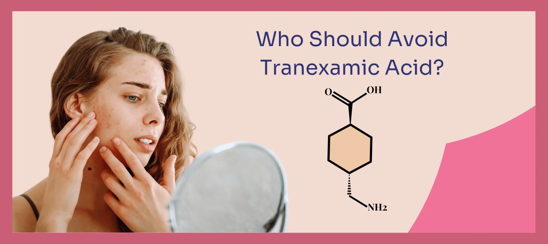 网红“氨甲环酸”被批准用于色斑治疗了吗？